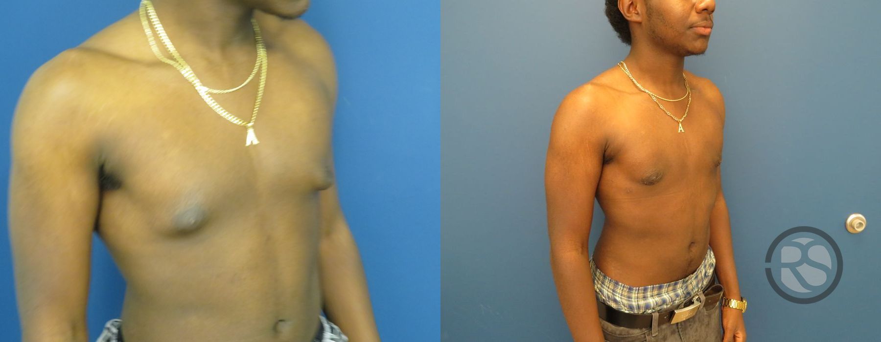 Before photo - Angle 2