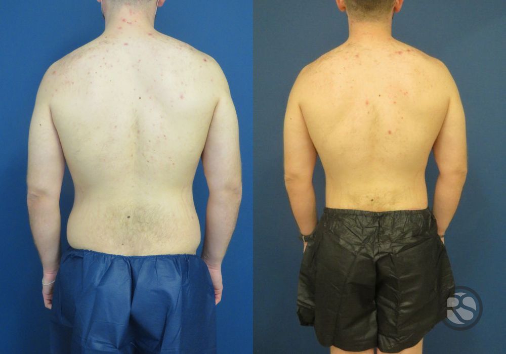 Before photo - Angle 6