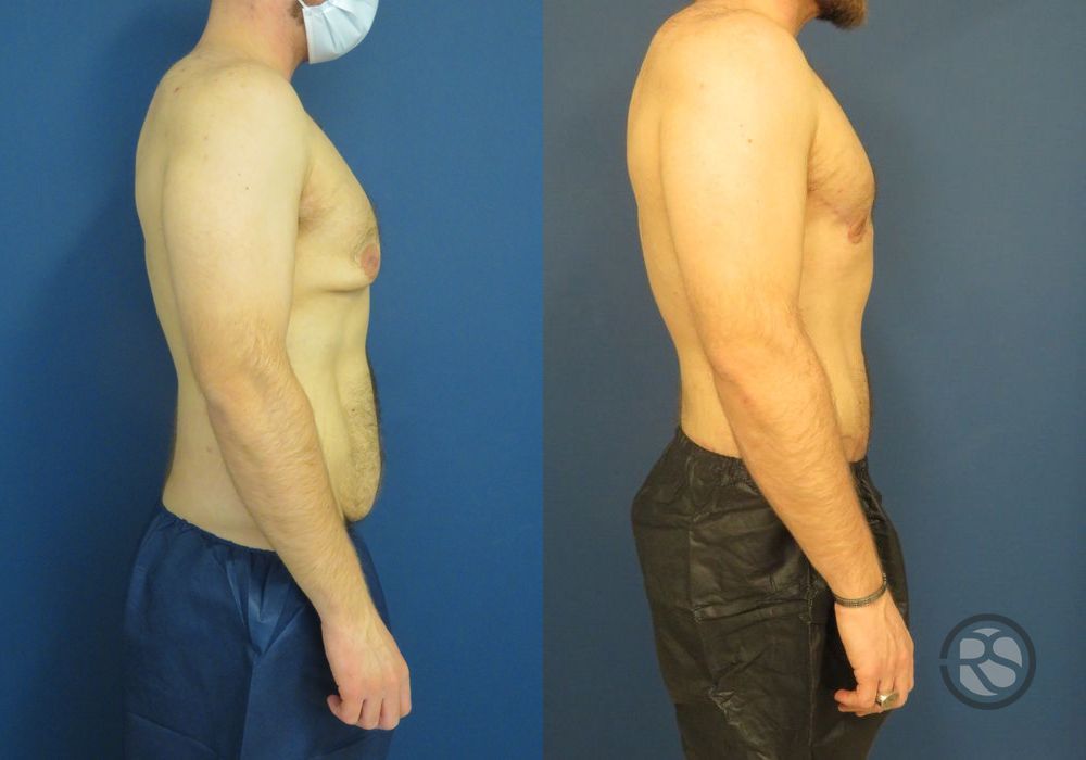 Before photo - Angle 5