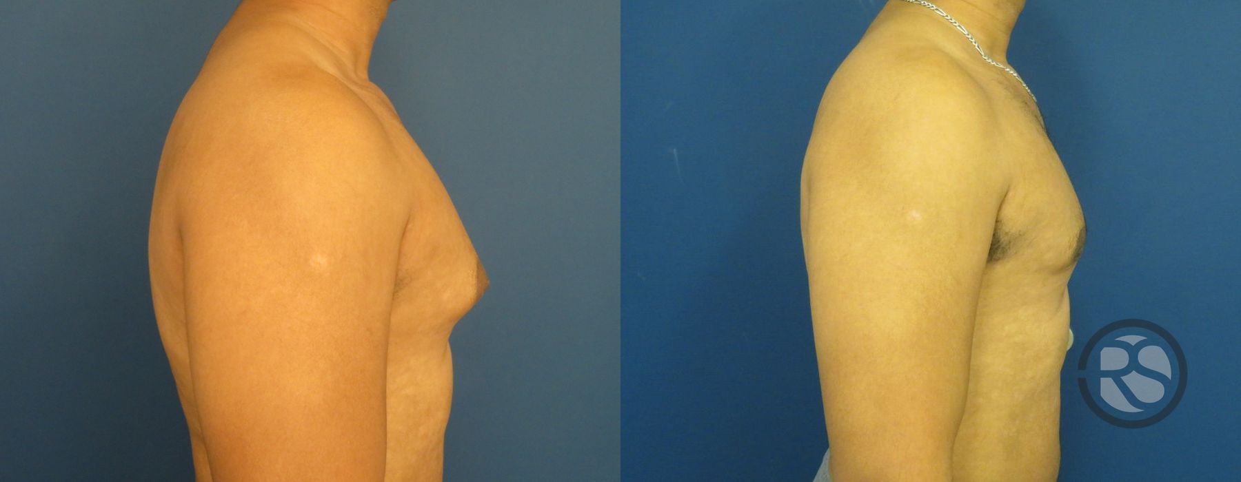 Before photo - Angle 3