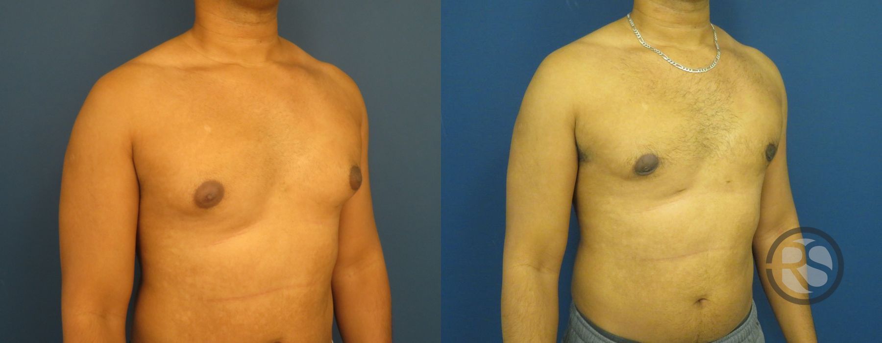 Before photo - Angle 2