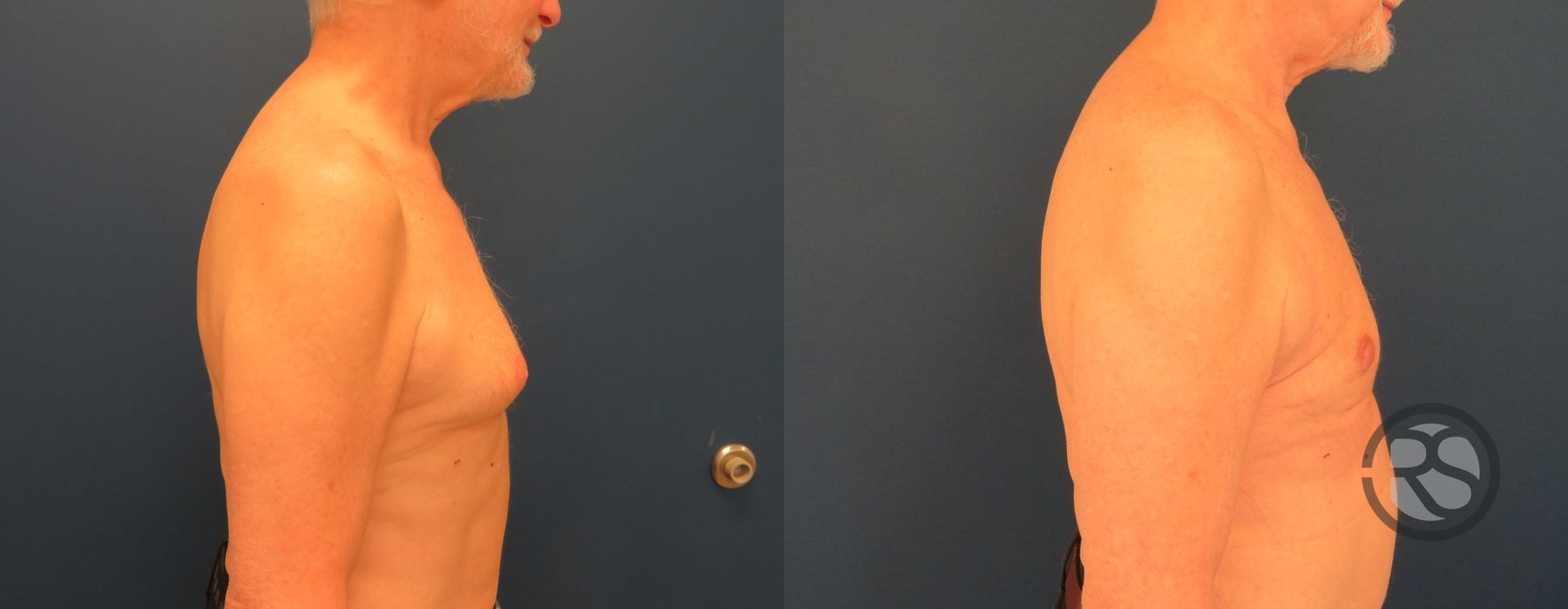 Before photo - Angle 2