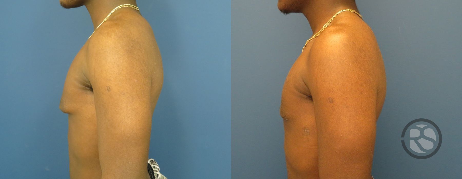 Before photo - Angle 5