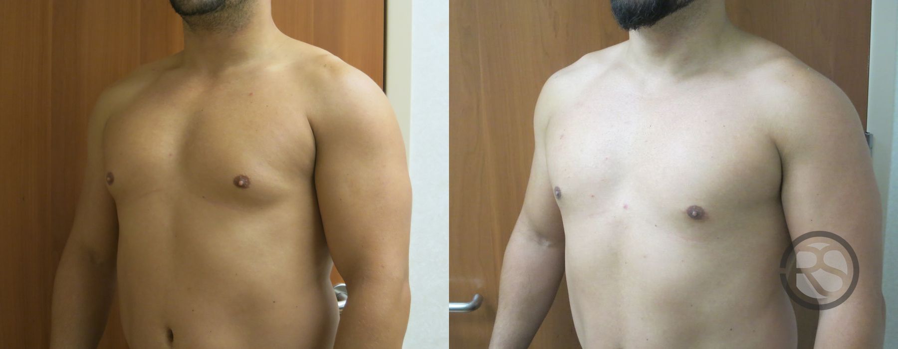 Before photo - Angle 4