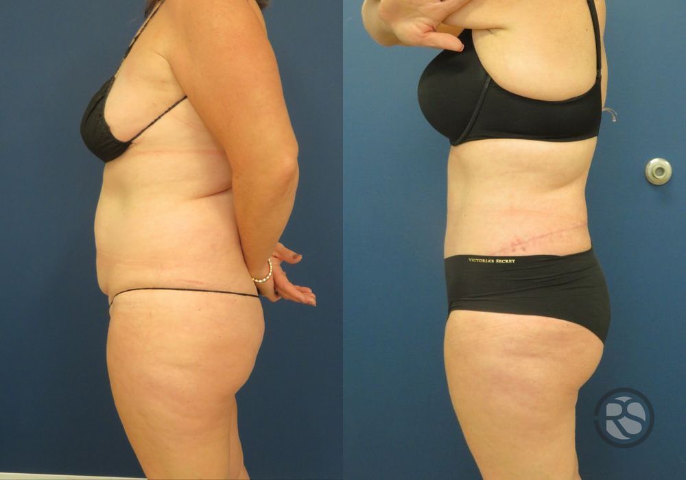 Before photo - Angle 5