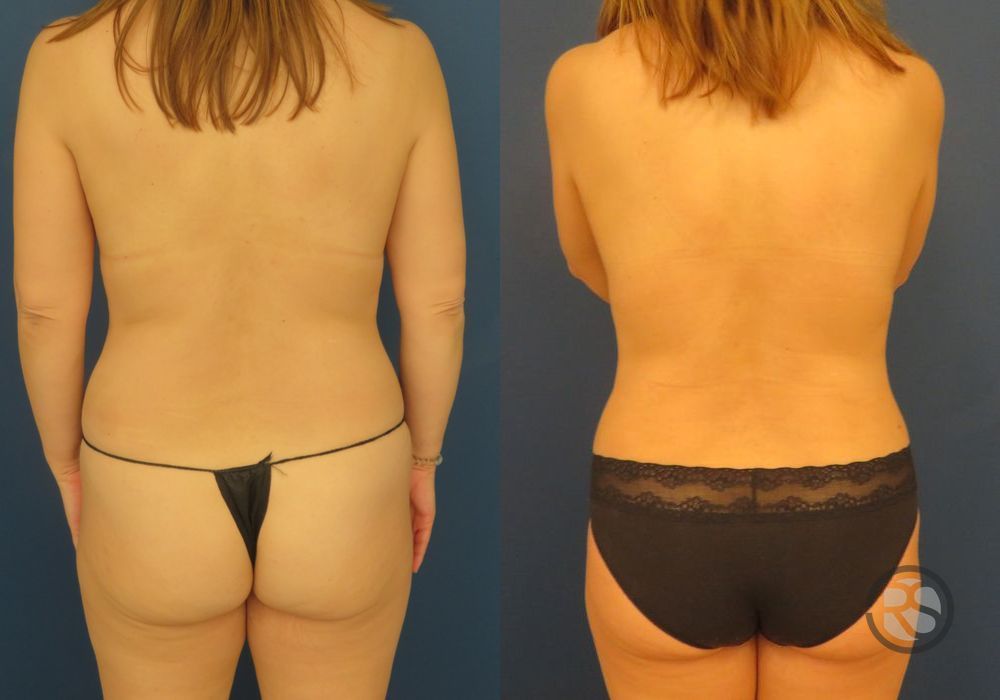 Before photo - Angle 6