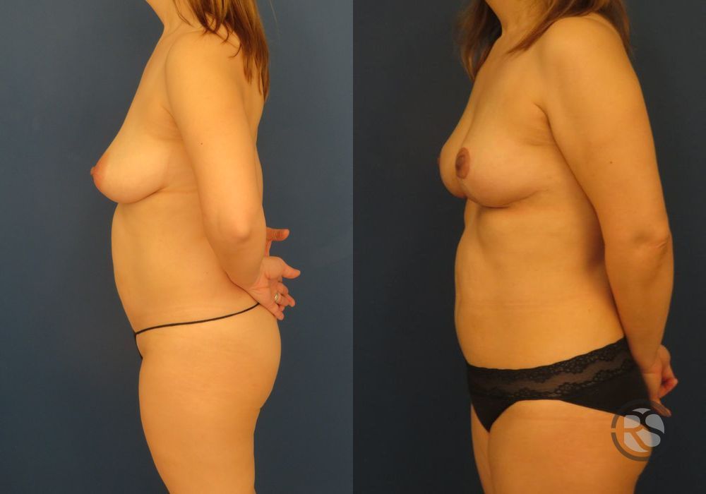 Before photo - Angle 5