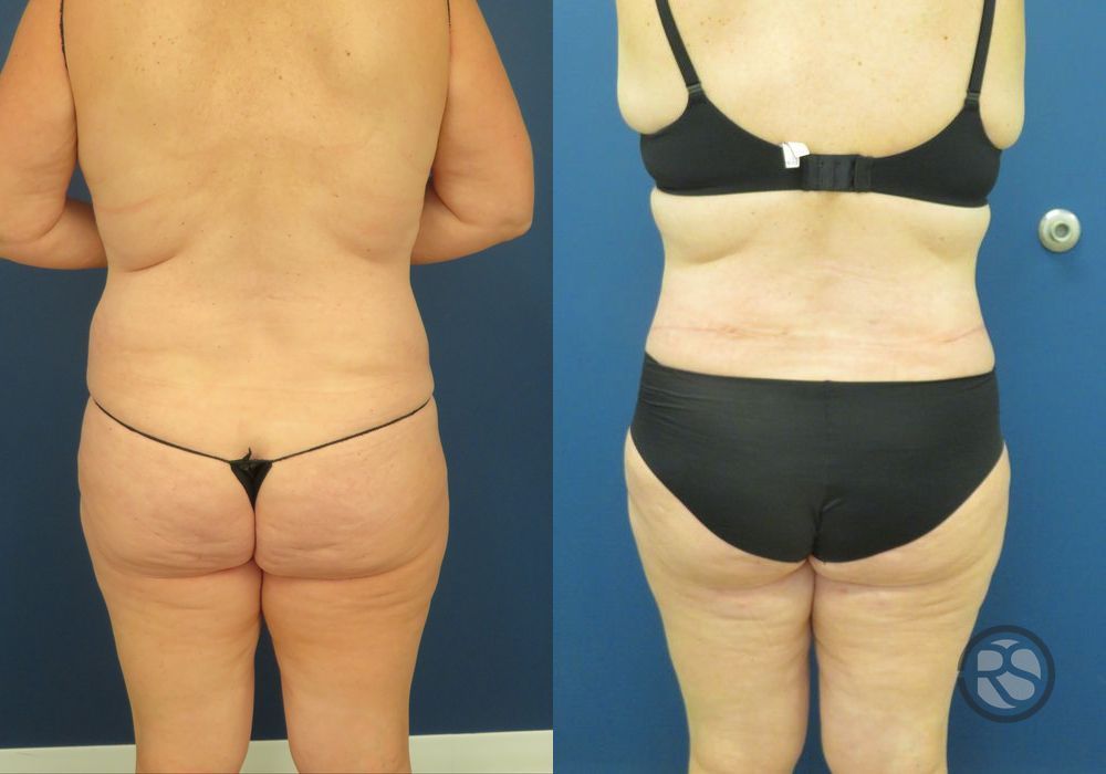 Before photo - Angle 6