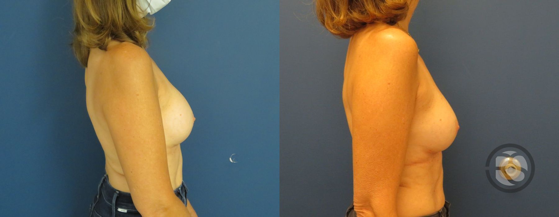 Before photo - Angle 3