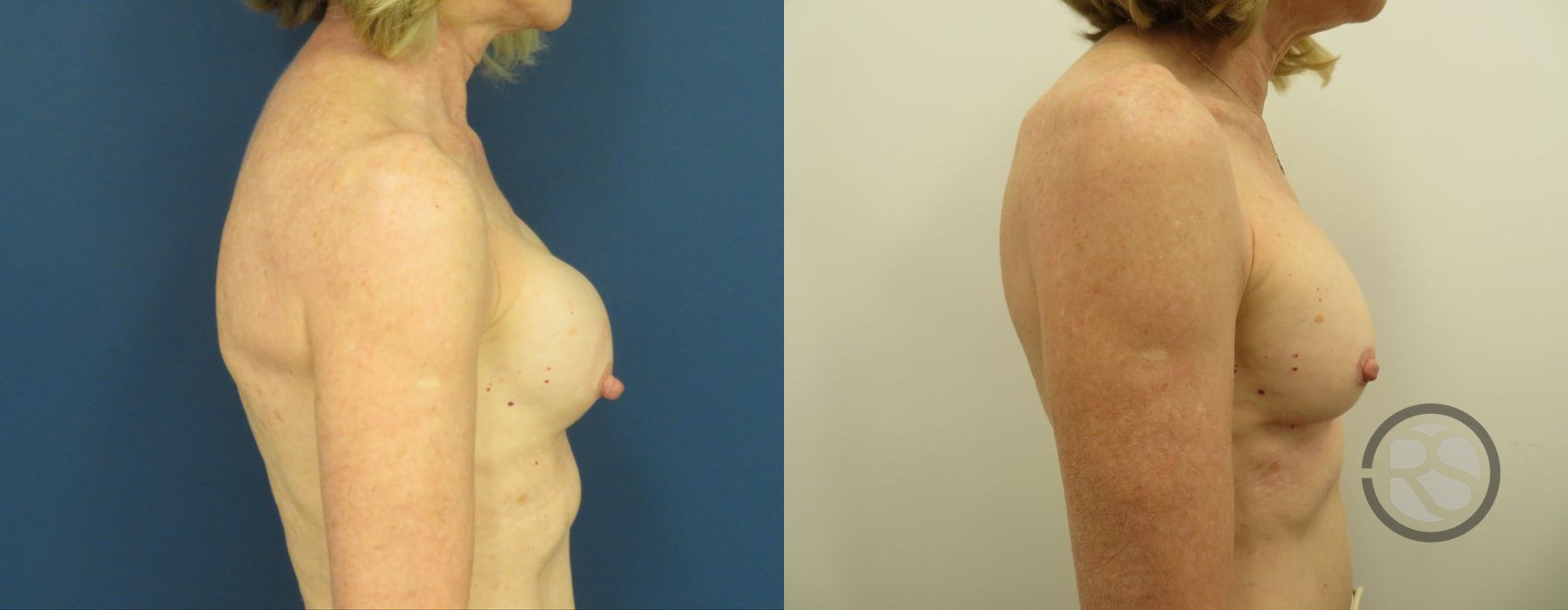 Before photo - Angle 2