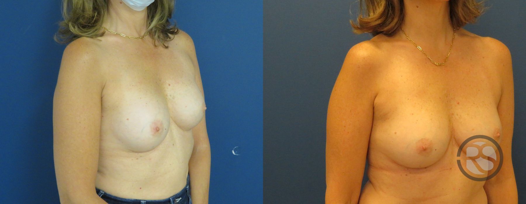 Before photo - Angle 2