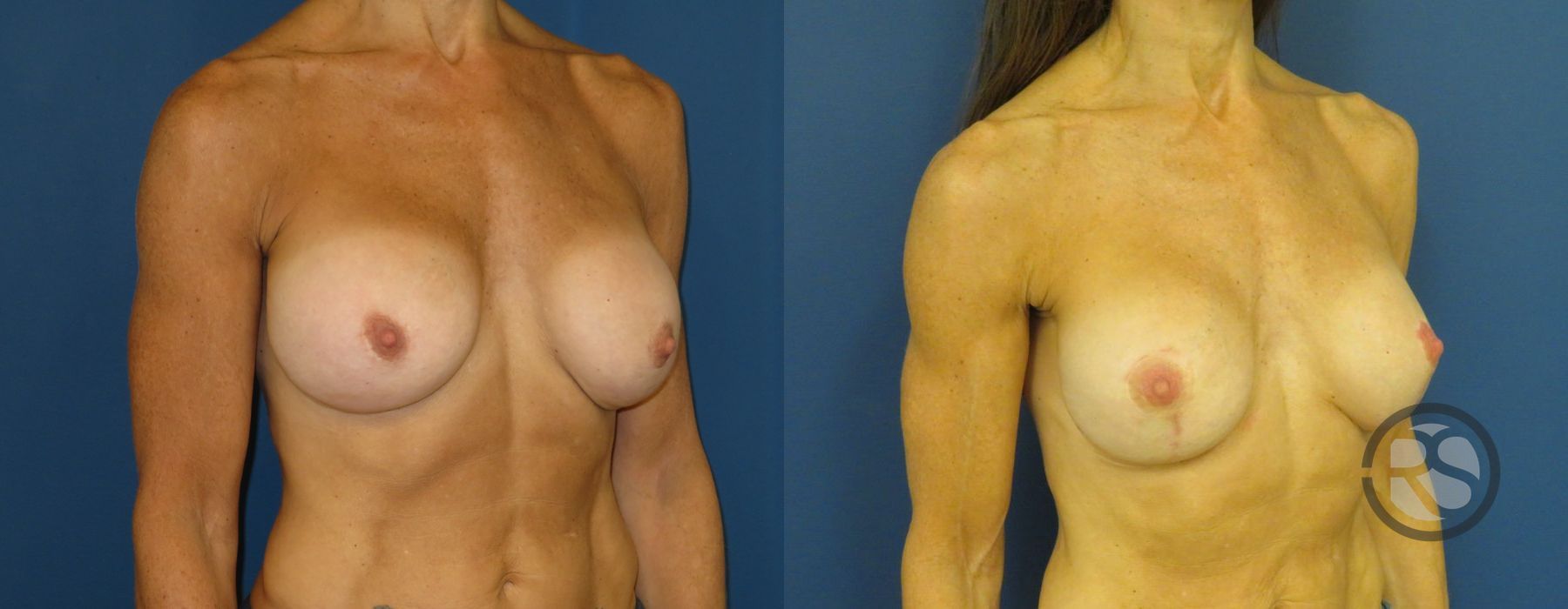 Before photo - Angle 2