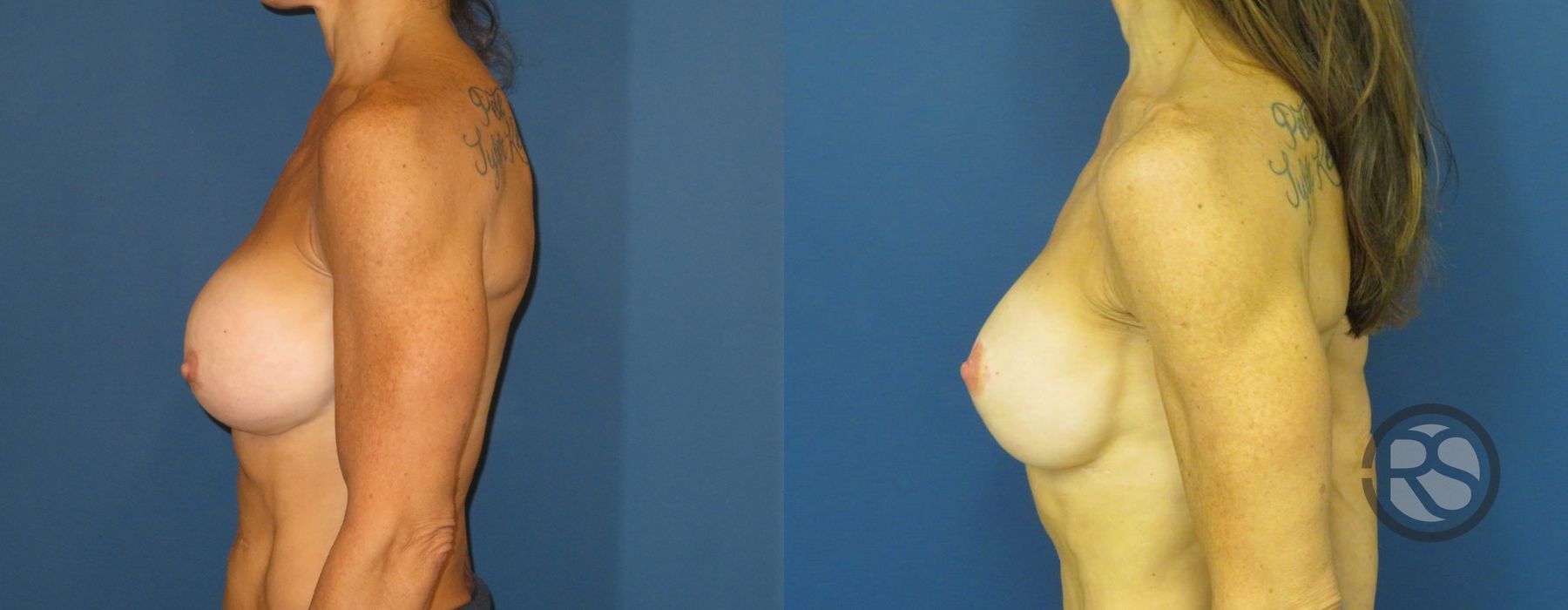 Before photo - Angle 5