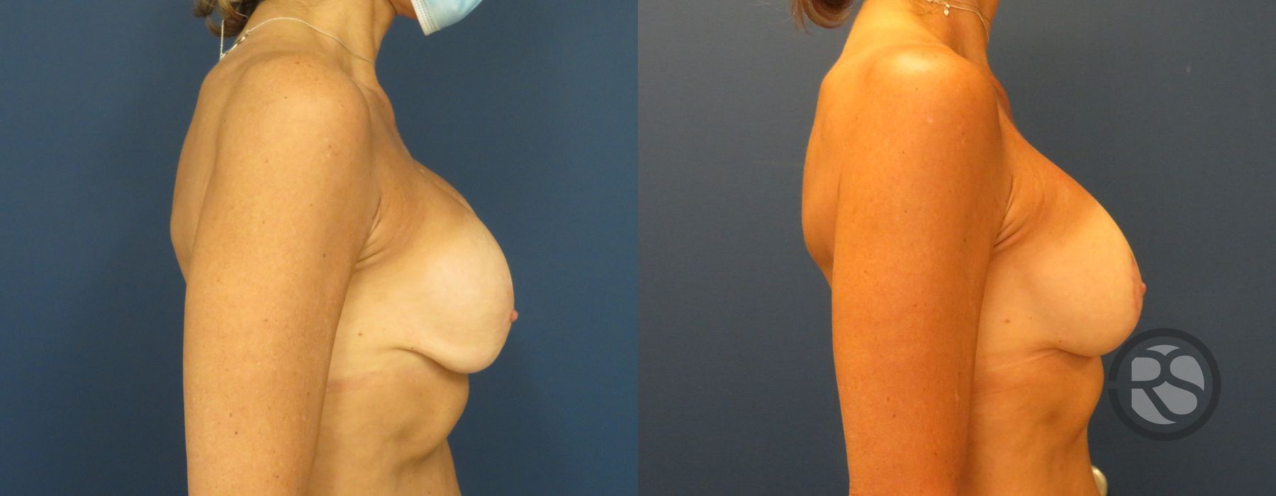 Before photo - Angle 3