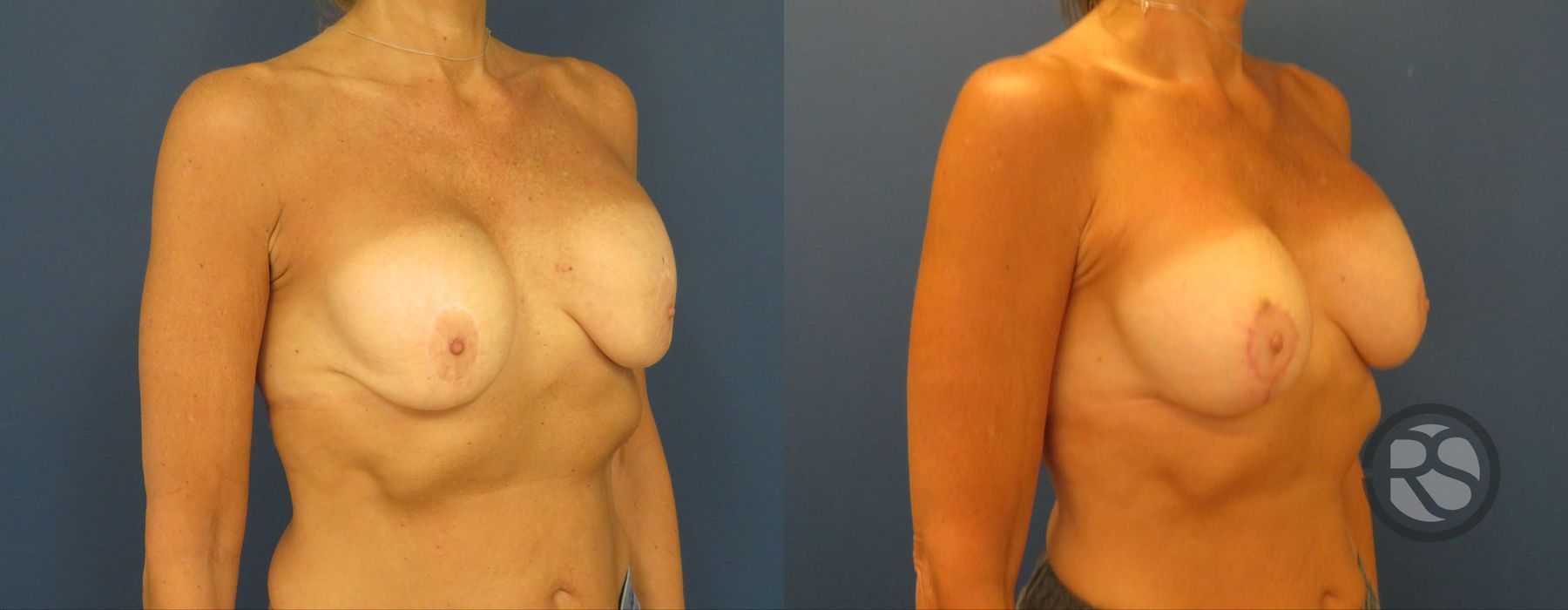 Before photo - Angle 2