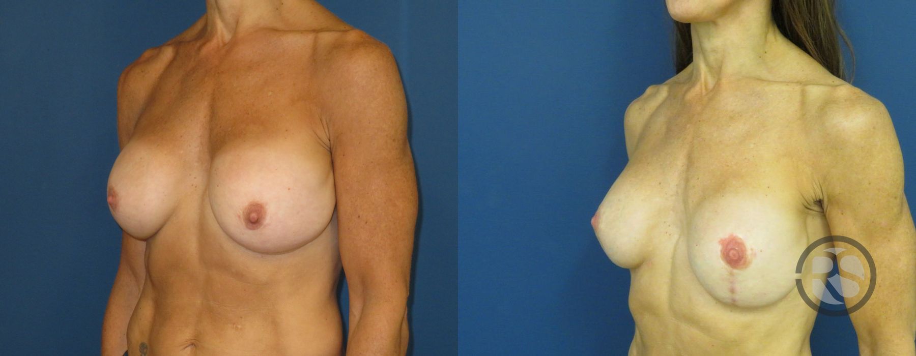 Before photo - Angle 4