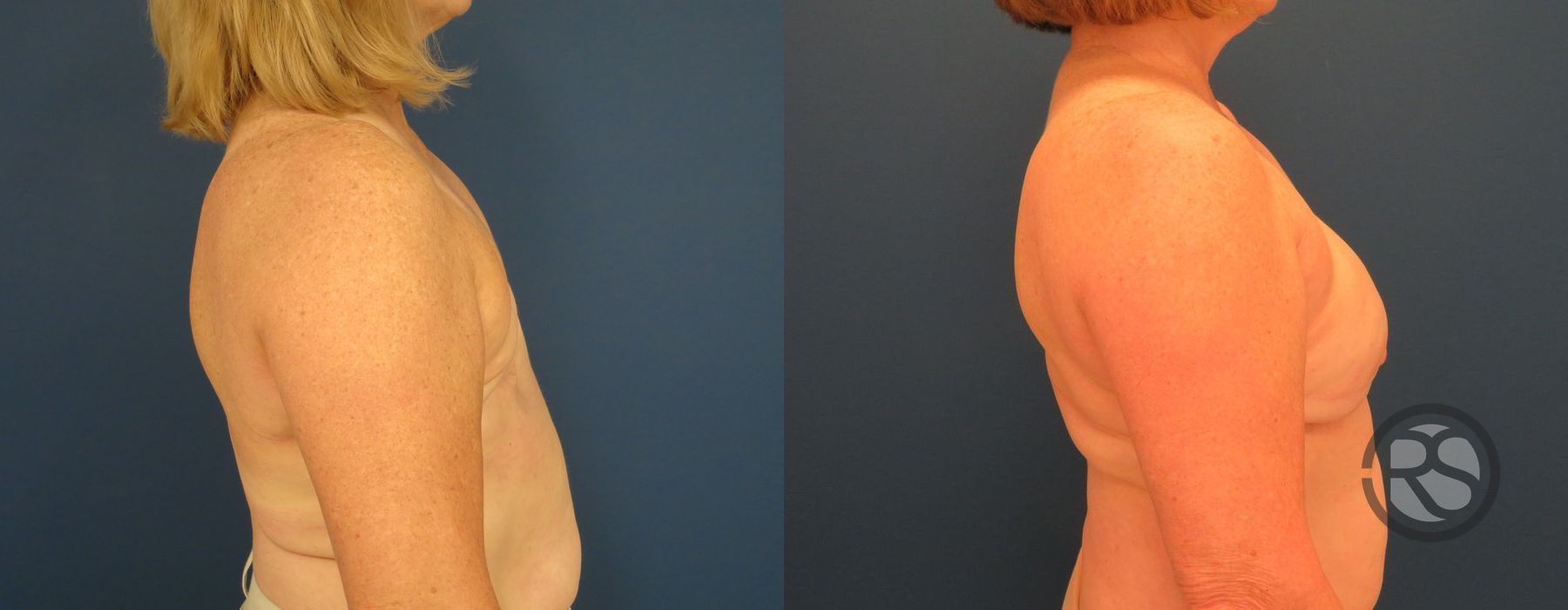 Before photo - Angle 5