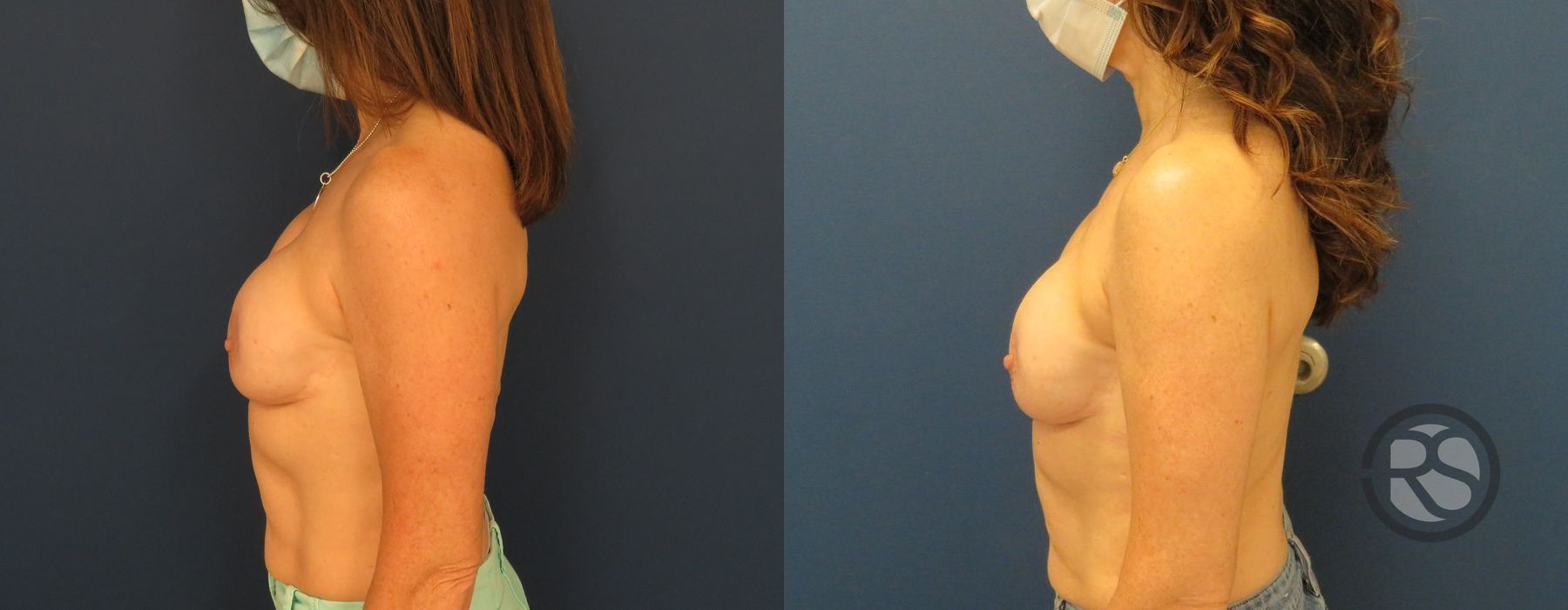 Before photo - Angle 5