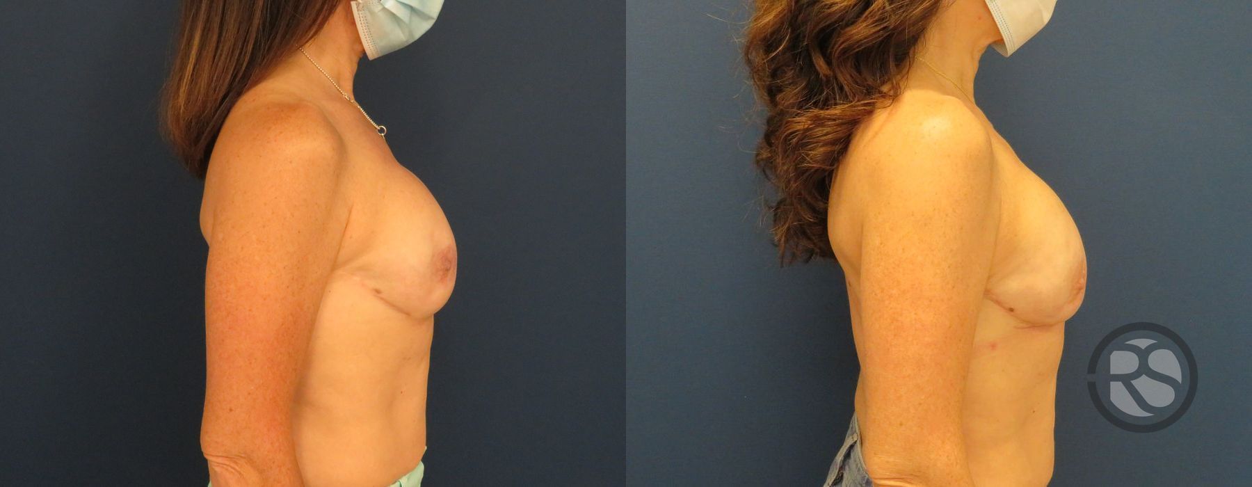 Before photo - Angle 3