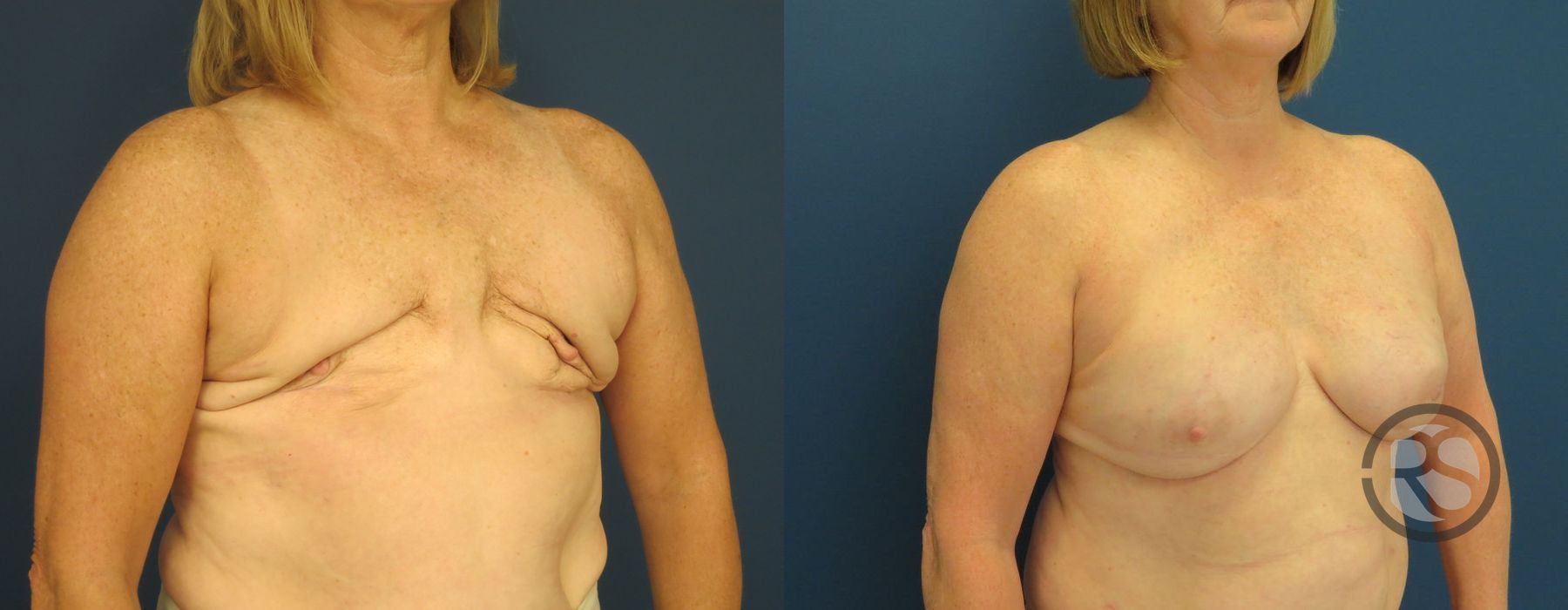 Before photo - Angle 2