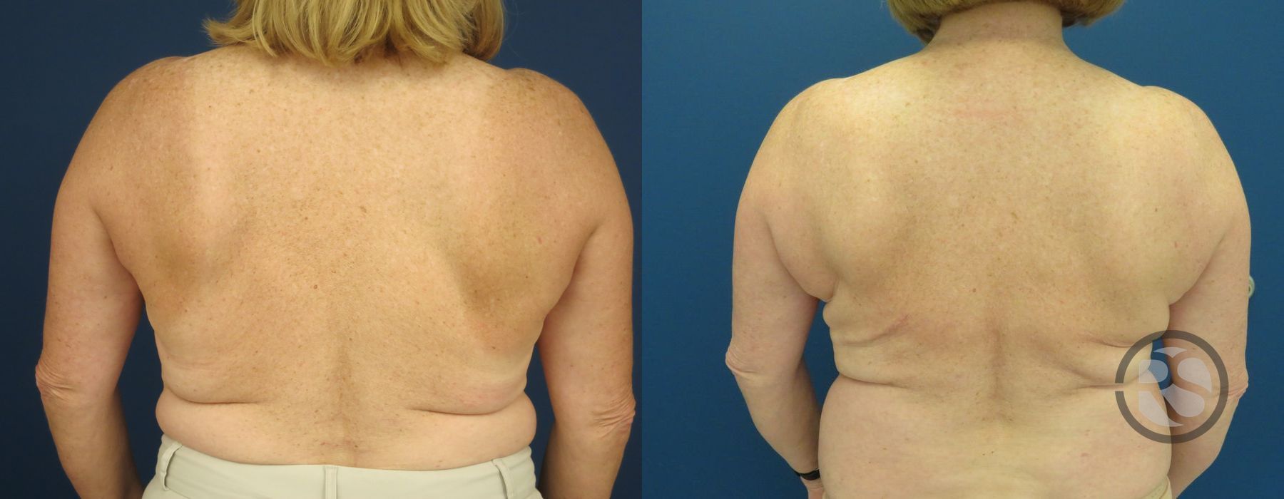 Before photo - Angle 6