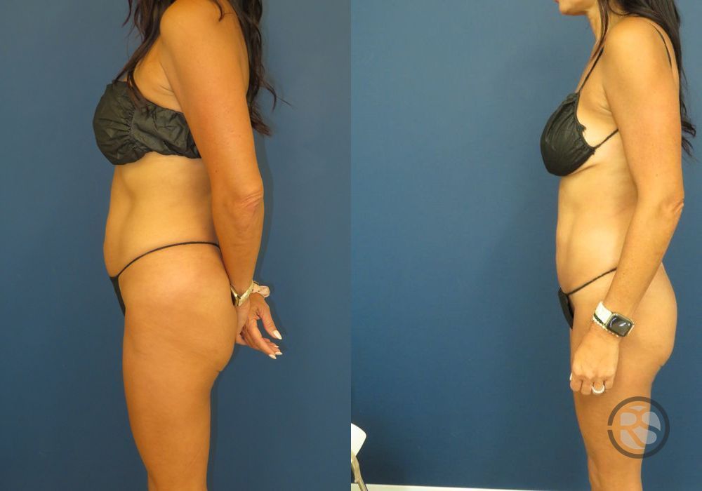 Before photo - Angle 5