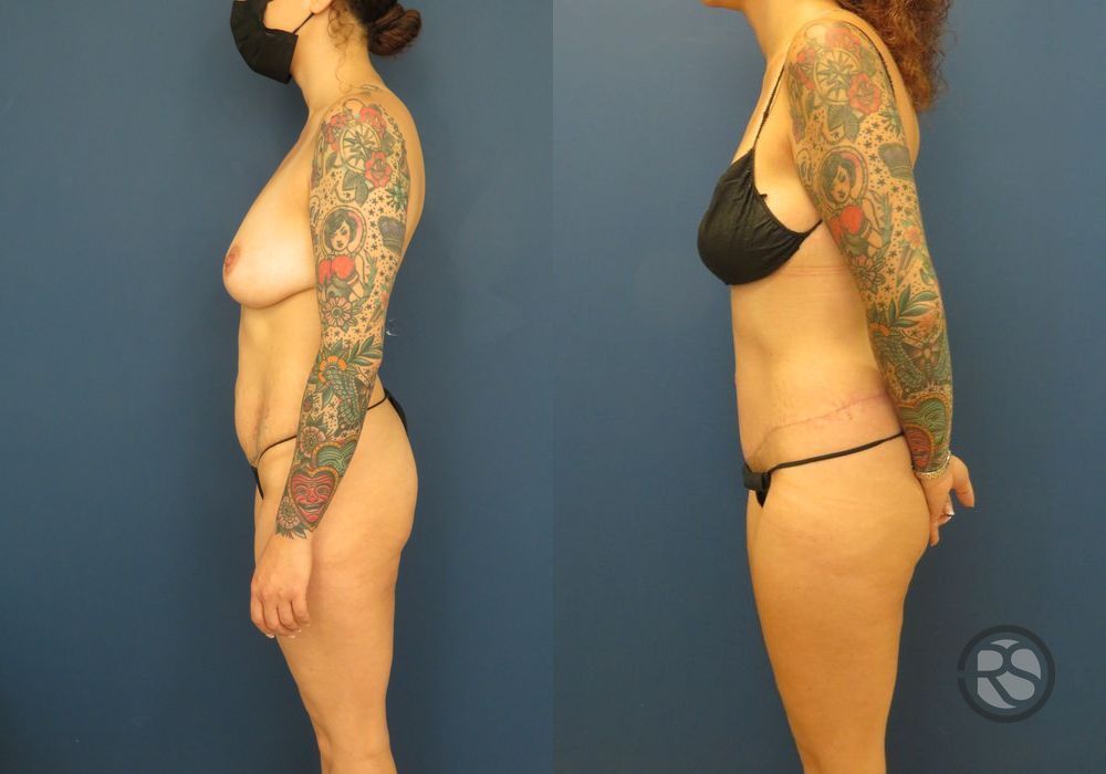 Before photo - Angle 5