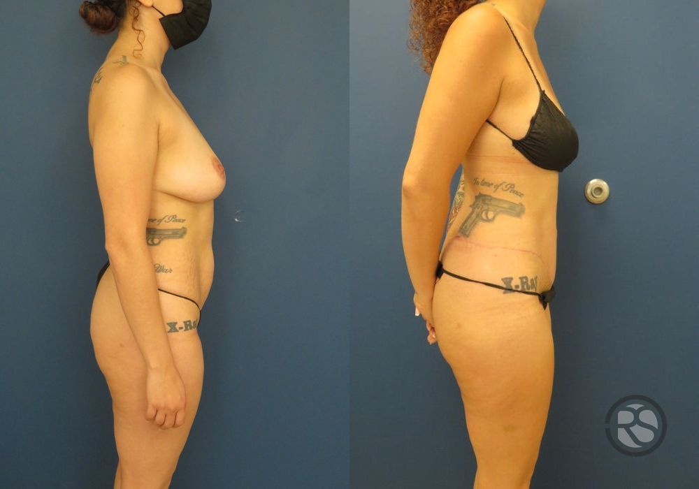 Before photo - Angle 3