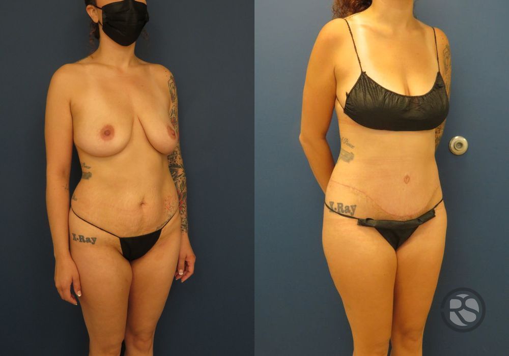 Before photo - Angle 2