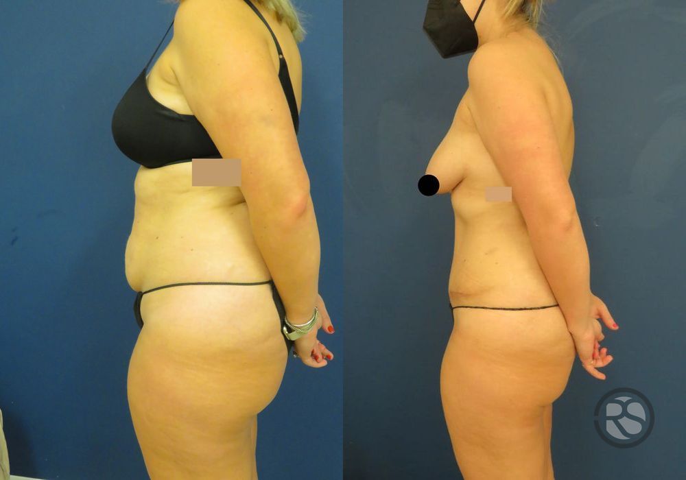 Before photo - Angle 5