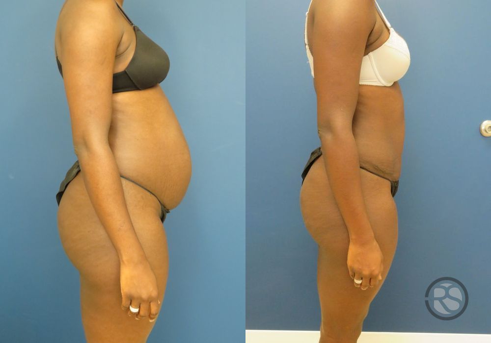 Before photo - Angle 3