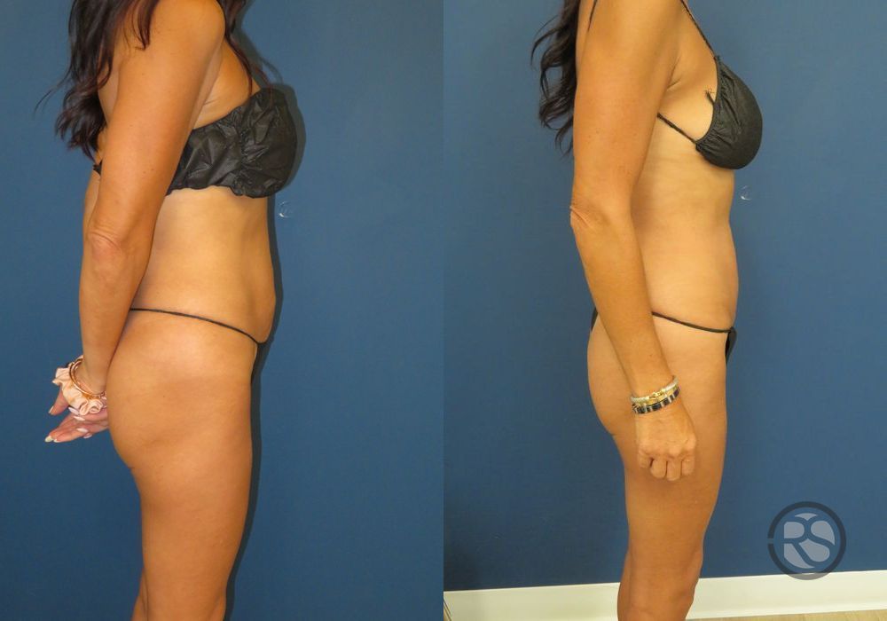 Before photo - Angle 3