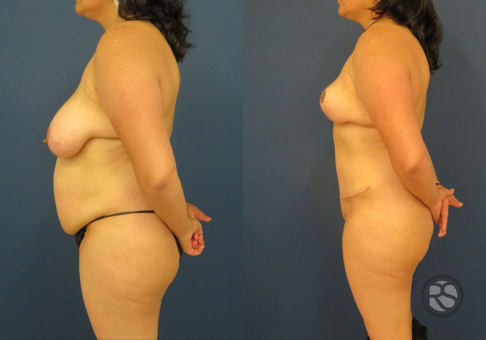 Before photo - Angle 5