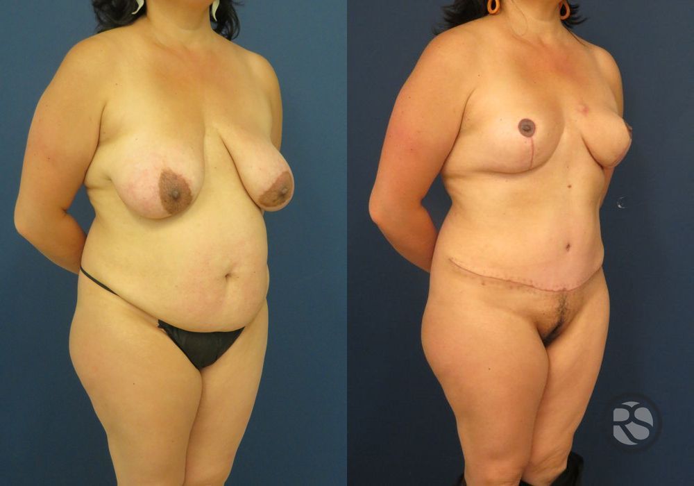 Before photo - Angle 2