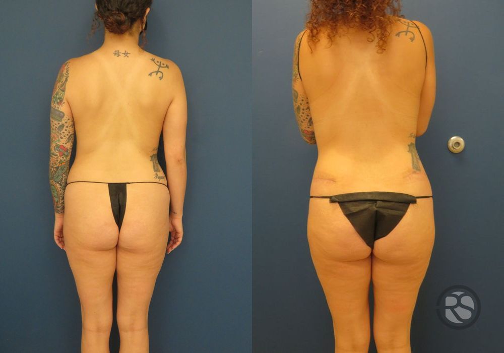 Before photo - Angle 6