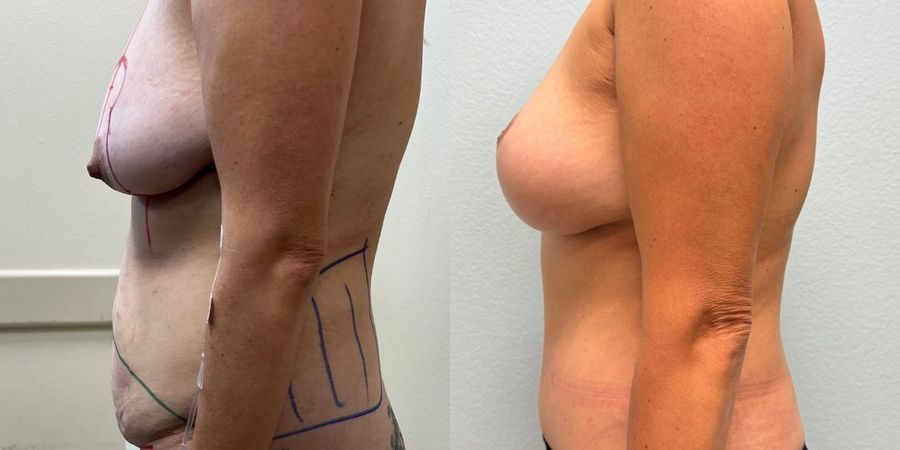 Before photo - Angle 3