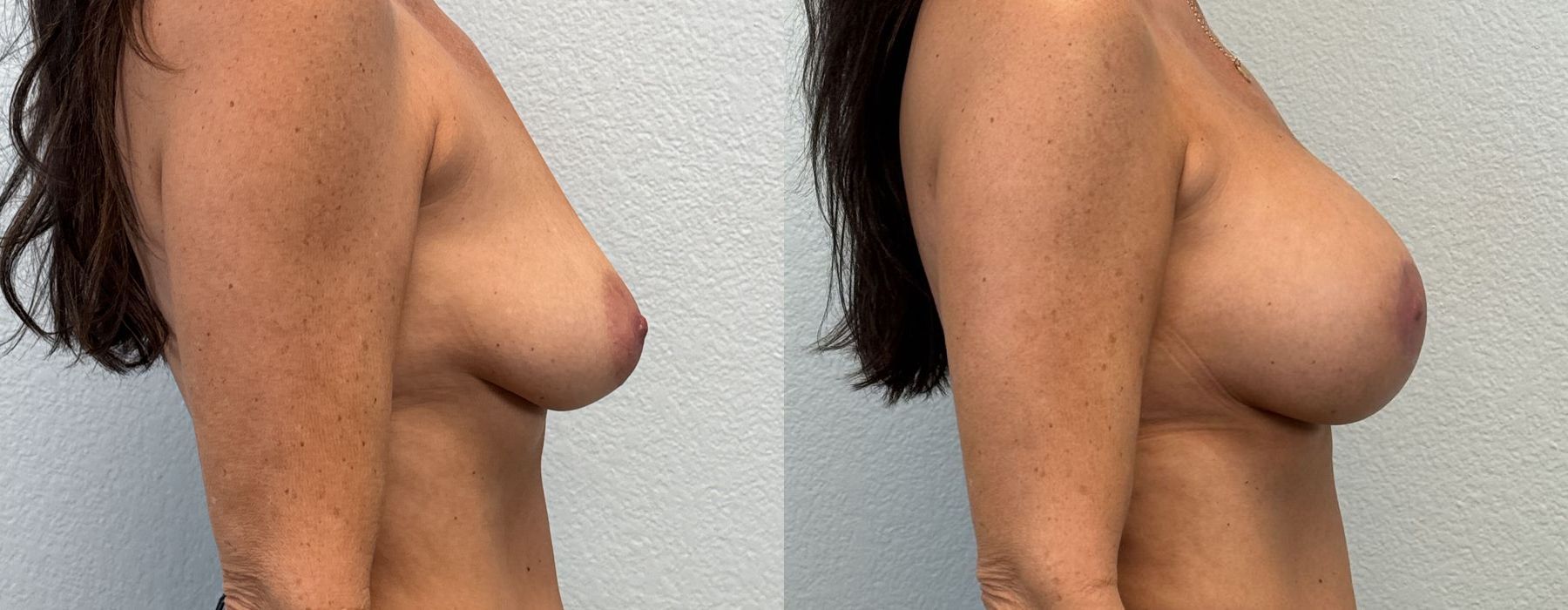 Before photo - Angle 3