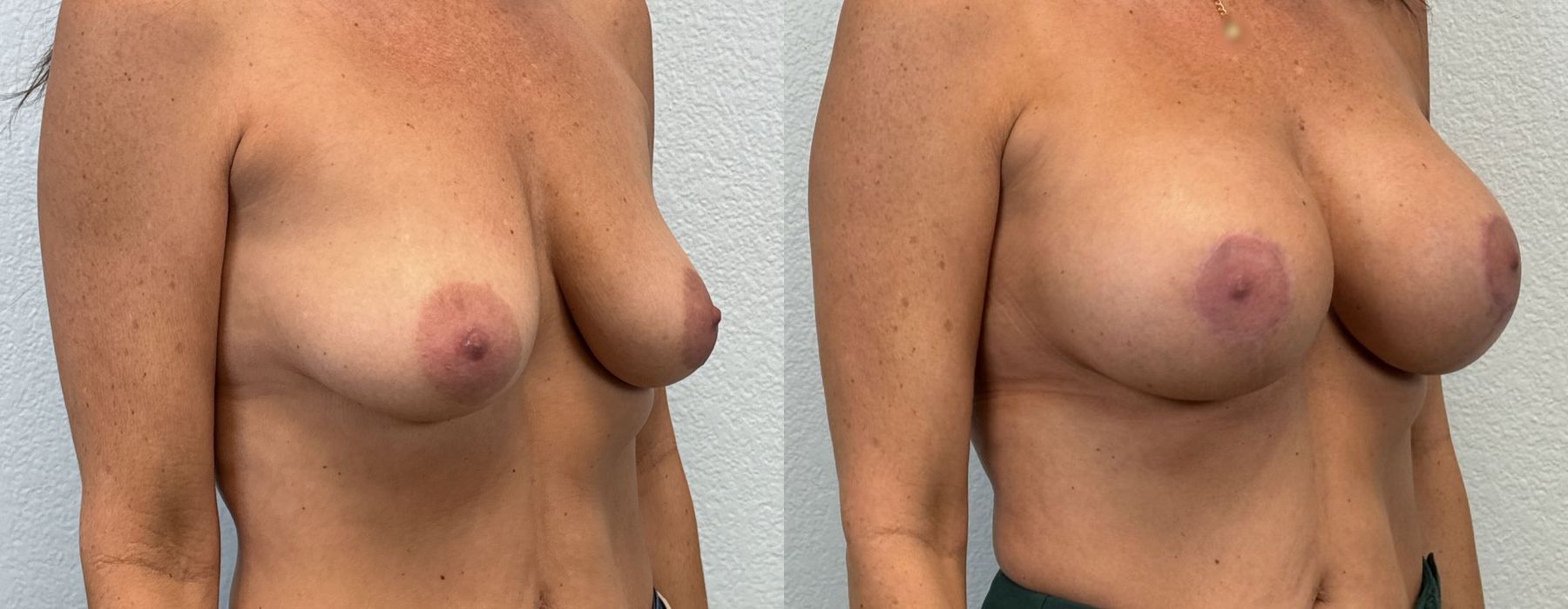 Before photo - Angle 2