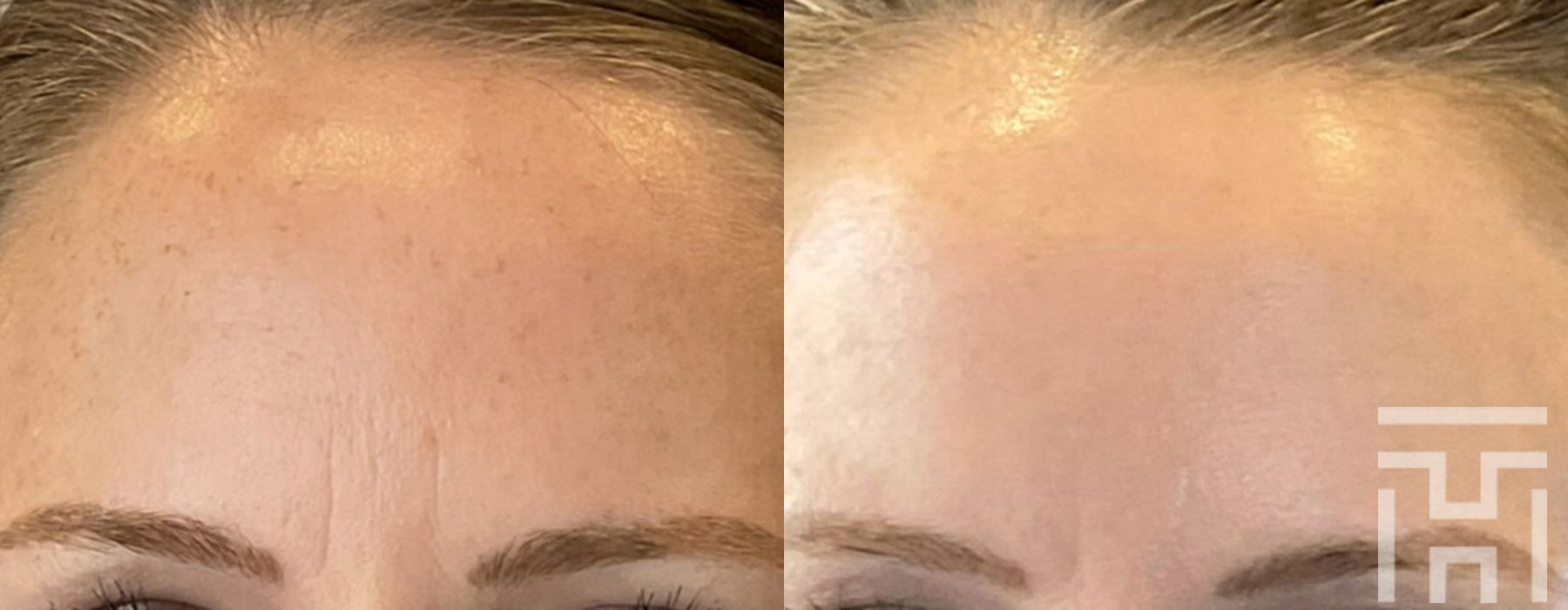 Halo™ - Thumbnail 2