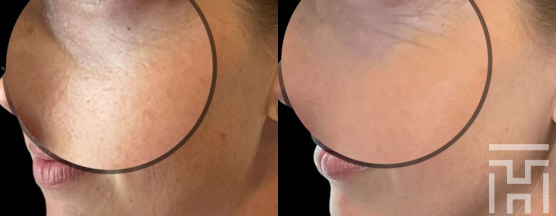 Halo™ - Thumbnail 5