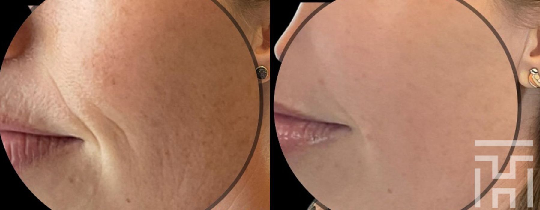 Halo™ - Thumbnail 4