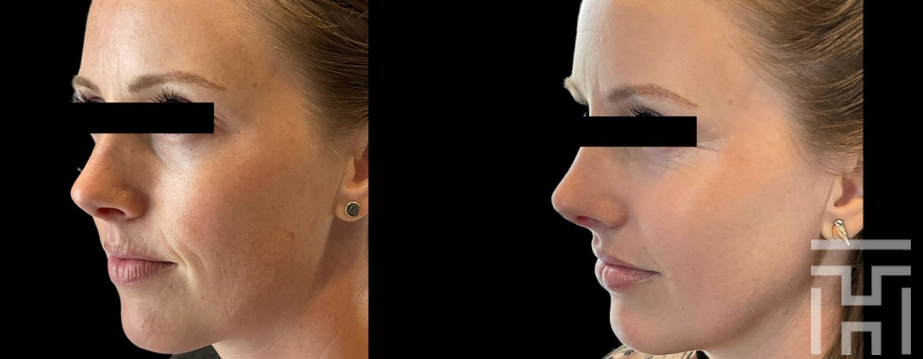 Halo™ - Thumbnail 3