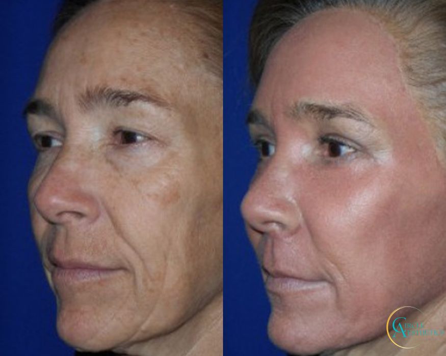 J-Plasma - Thumbnail 2