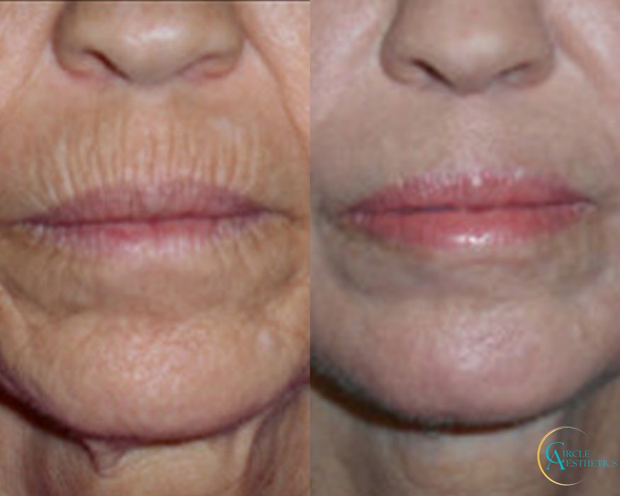 J-Plasma - Thumbnail 2