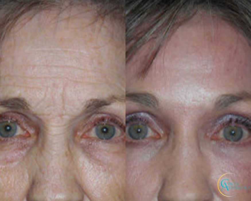 J-Plasma - Thumbnail 3