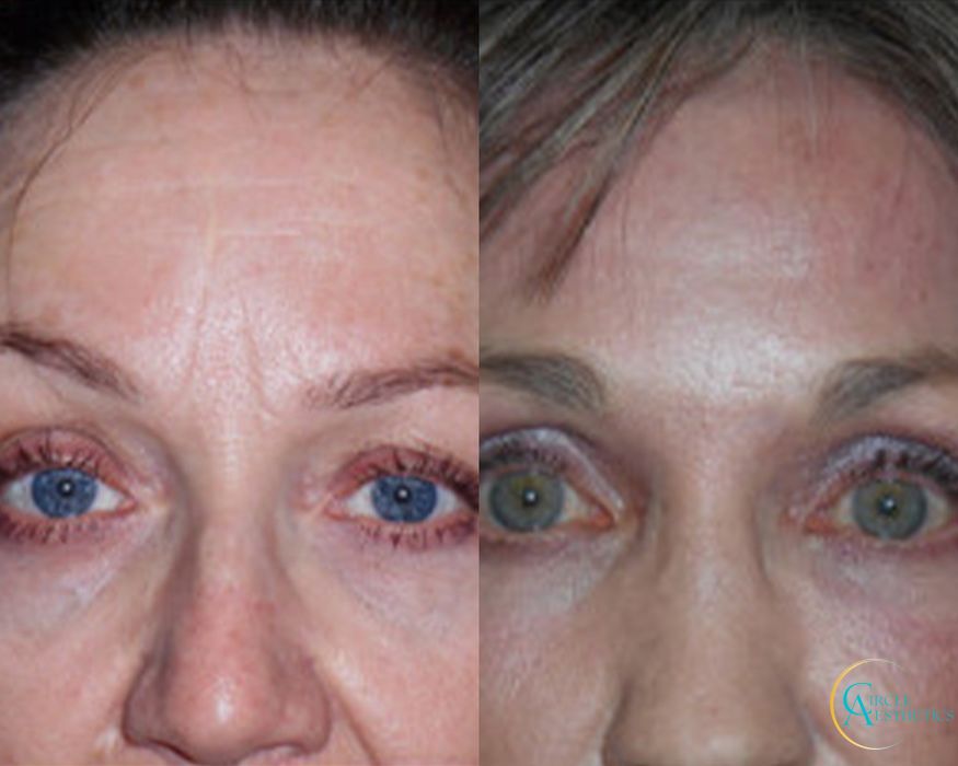 J-Plasma - Thumbnail 3