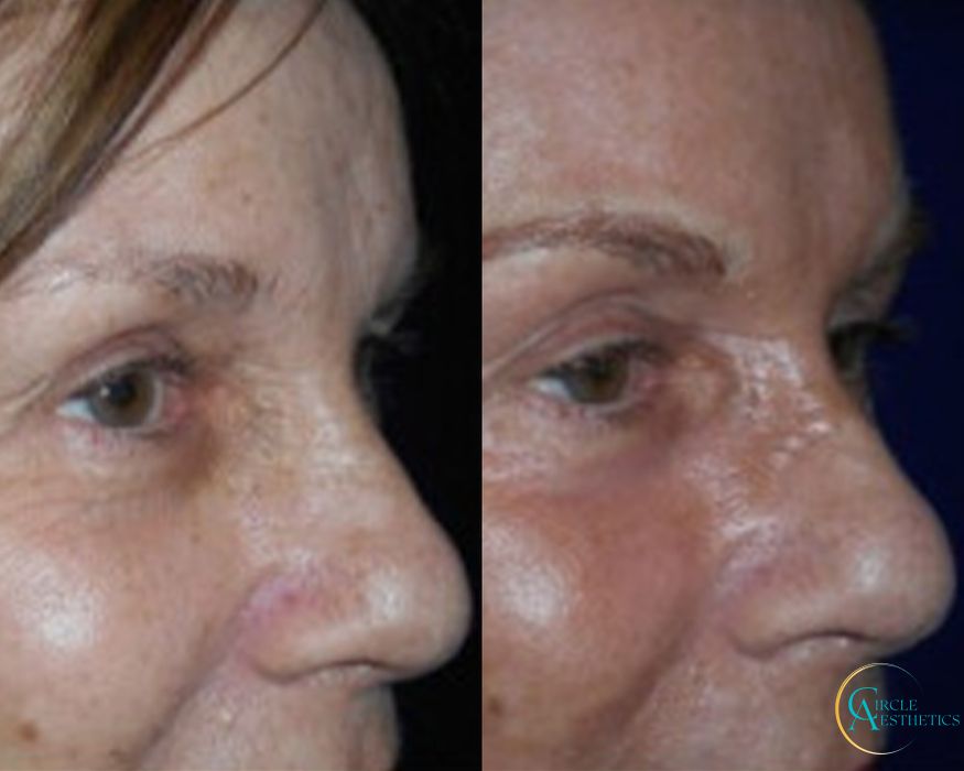 J-Plasma - Thumbnail 2