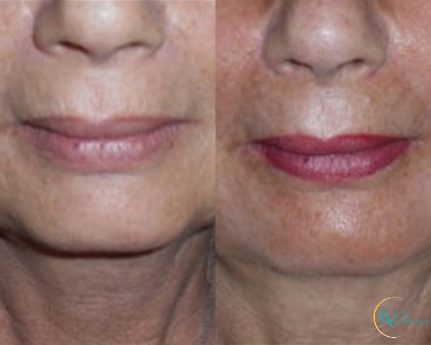 J-Plasma - Thumbnail 3