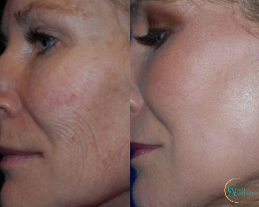 J-Plasma - Thumbnail 4