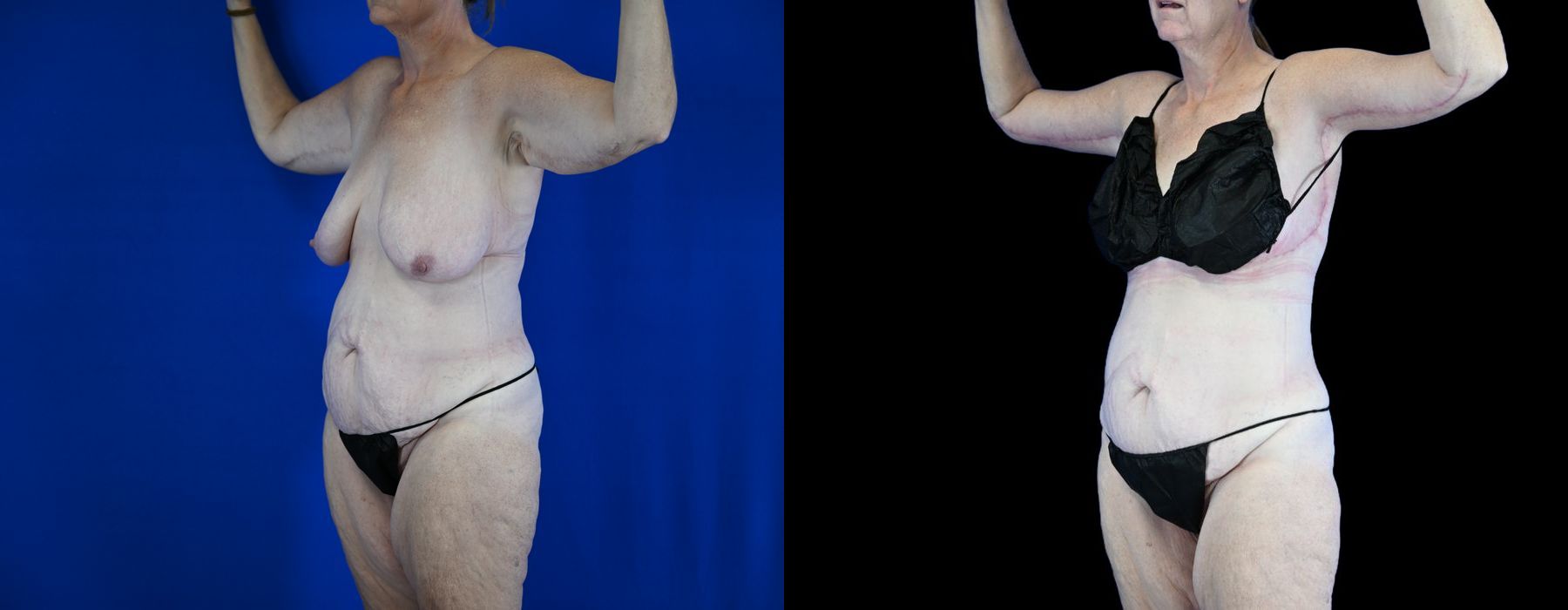 Before photo - Angle 2